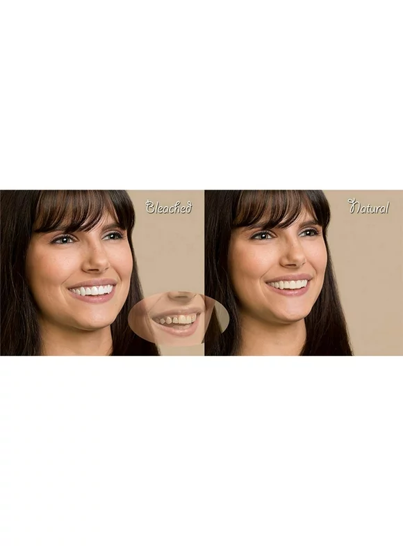VICOODA Temporary Denture,Denture Teeth Top + Lower Cosmetic Veneer 2PCS Unisex