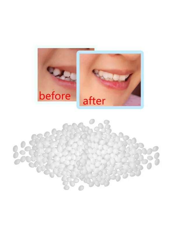 SUPERHOMUSE Dental Missing Teeth Repair Temporary Materials Solid Glue Denture Adhesive Oral Hygiene Orthodontic Braces