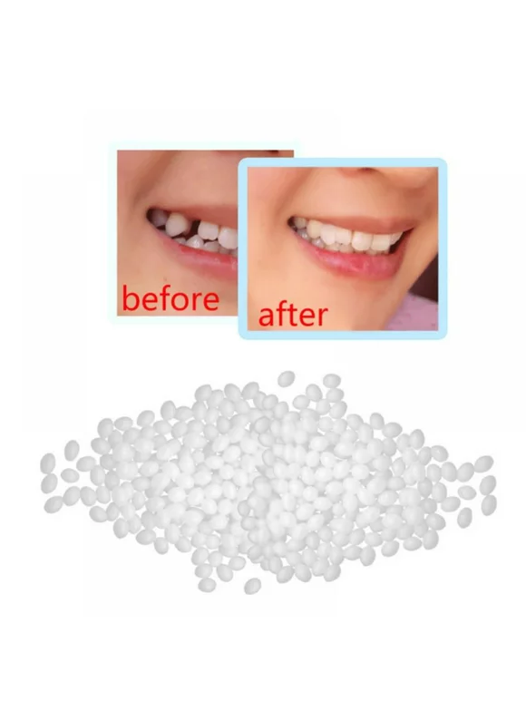 Final Clearance! Temporary Tooth Repair Kit Moldable Thermal Fitting Beads for Snap On Instant and Confident Perfect Smile Comfort Fit Flexible Makeover Adhesive Denture